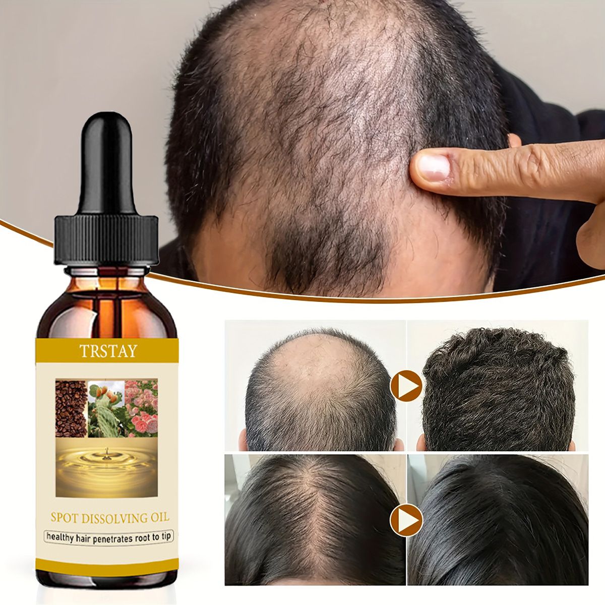 Beard Oil Growth - 男性と女性のためのあごひげエッセンシャルオイル,ヘアケア製品,50ml