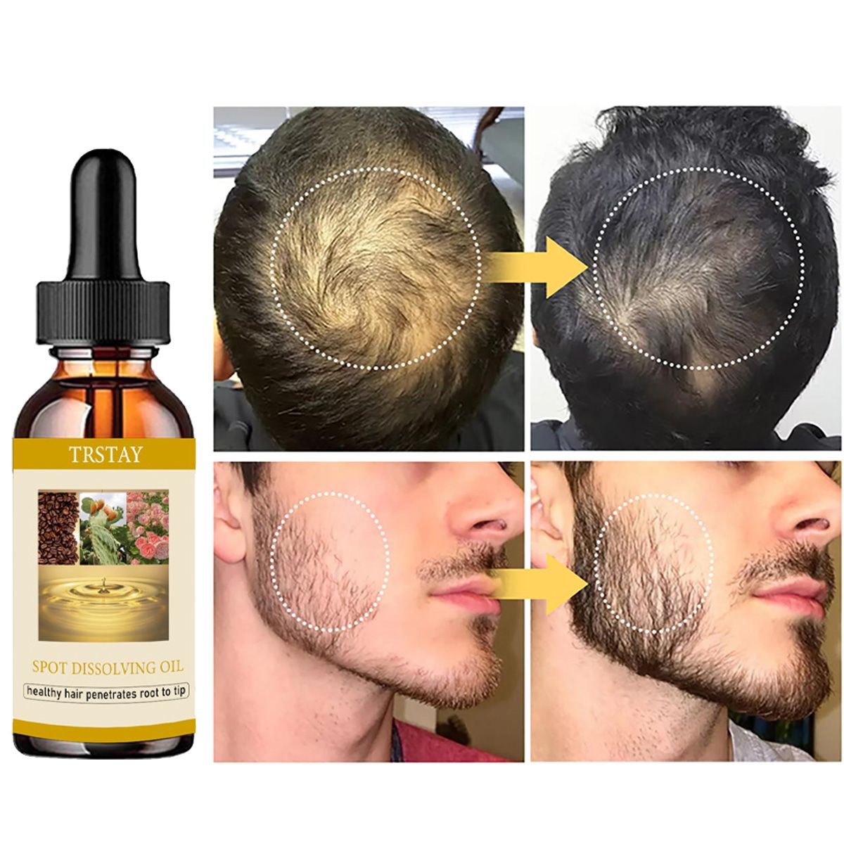男性と女性のためのあごひげエッセンシャルオイル,ヘアケア製品 - Beard Oil Growth のレビューと価格