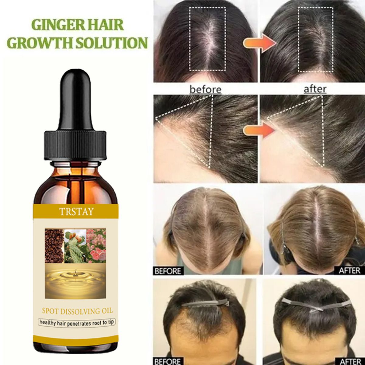 男性と女性のためのあごひげエッセンシャルオイル,ヘアケア製品 - Beard Oil Growth のレビューと価格