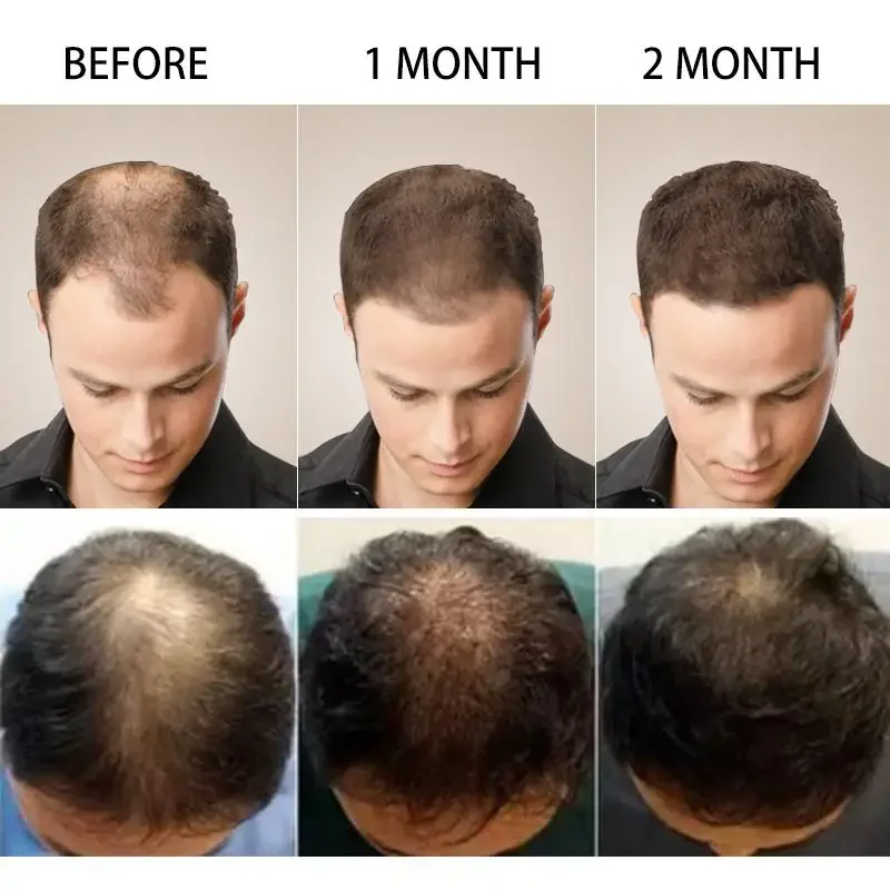 育毛ジンジャー高速成長髪エッセンシャルオイルヘアケア損失防止 - Beard Oil Growth のレビューと価格