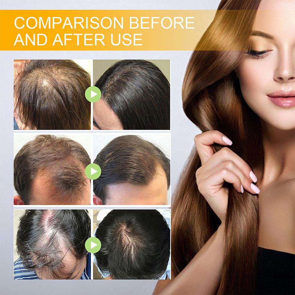 5/3/1 個ビオチン高速育毛製品抗脱毛血清スプレーはげ防止 - Beard Oil Growth のレビューと価格